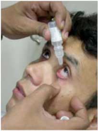 How to Use Eye Drops