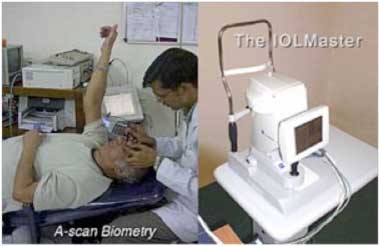IOL Power Calculation