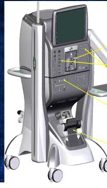 Treating-retinal-detachment-5