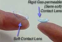 What-are-the-types-of-Contact-Lenses-available-