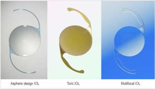 What-are-the-various-types-of-Intraocular-Lenses-(IOLs)-which-can-be-implanted-in-the-eye-