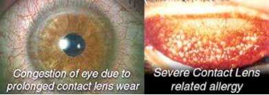 Why-is-it-necessary-for-contact-lens-wearers-to-have-regular-eye-exams-even-if-their-prescription-hasn't-changed-