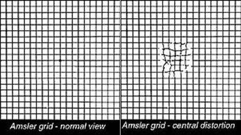 grid