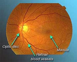 The Retina - Shroff Eye Centre