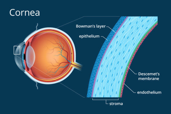 Corneal Transplant Surgery Hospital in Delhi NCR