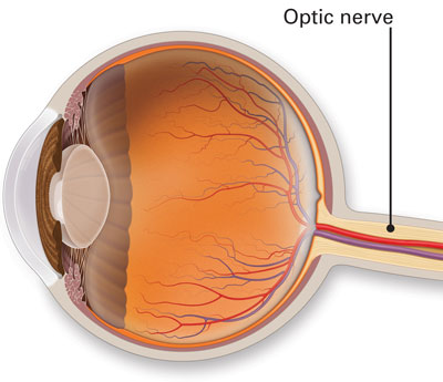 Neuro Ophthalmology Hospital in Delhi NCR