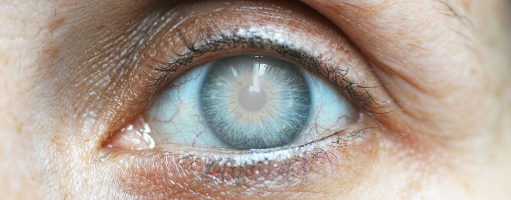 Could I have Glaucoma?<br>Symptoms to watch out for.