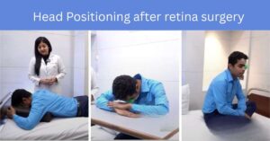 Why is proper head positioning crucial after your retina surgery?