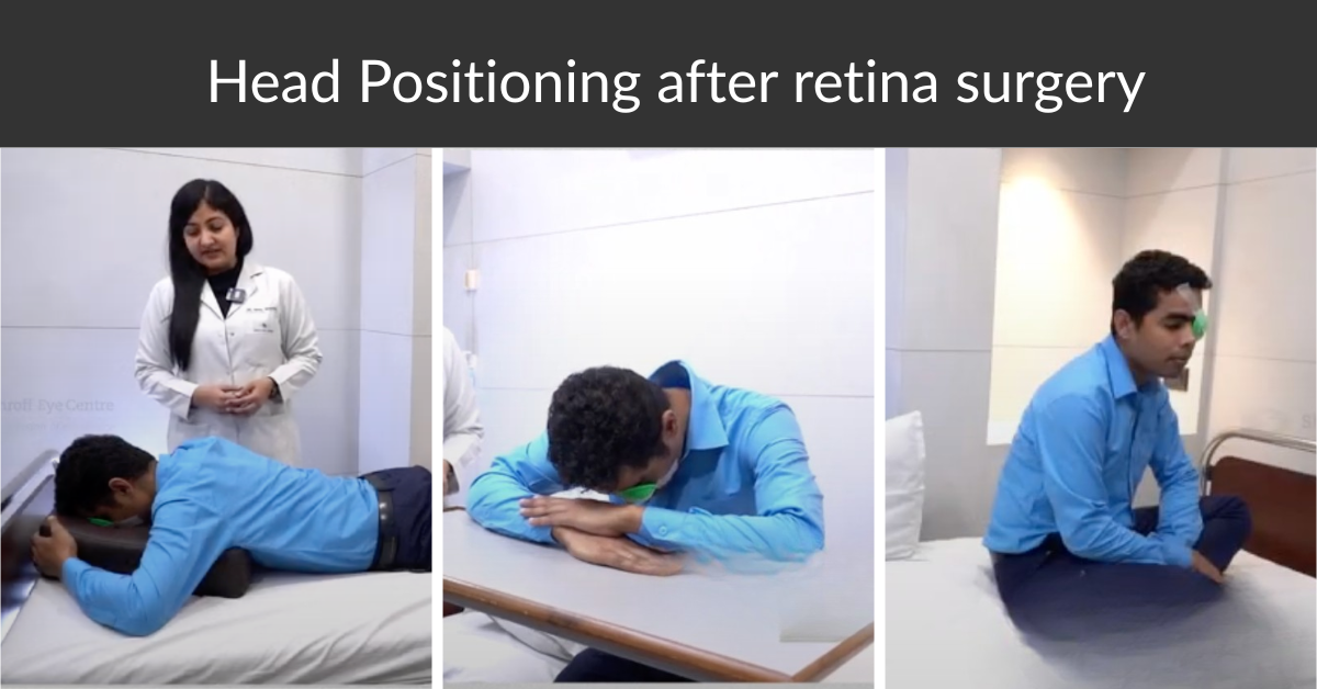 Why is proper head positioning crucial after your retina surgery?