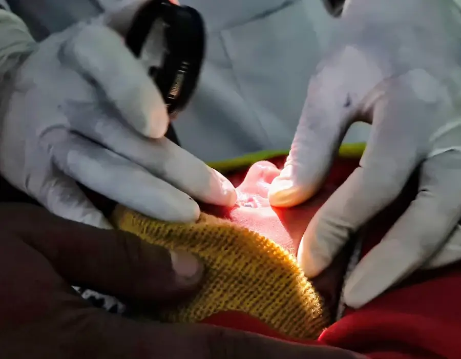 Premature baby being screened for ROP at Shroff Eye Centre