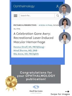 We  documented a striking case of recreational laser-induced macular hemorrhage