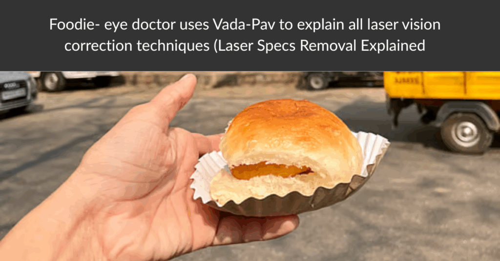 Foodie- eye doctor uses Vada-Pav to explain all laser vision correction techniques (Laser Specs Removal Explained)
